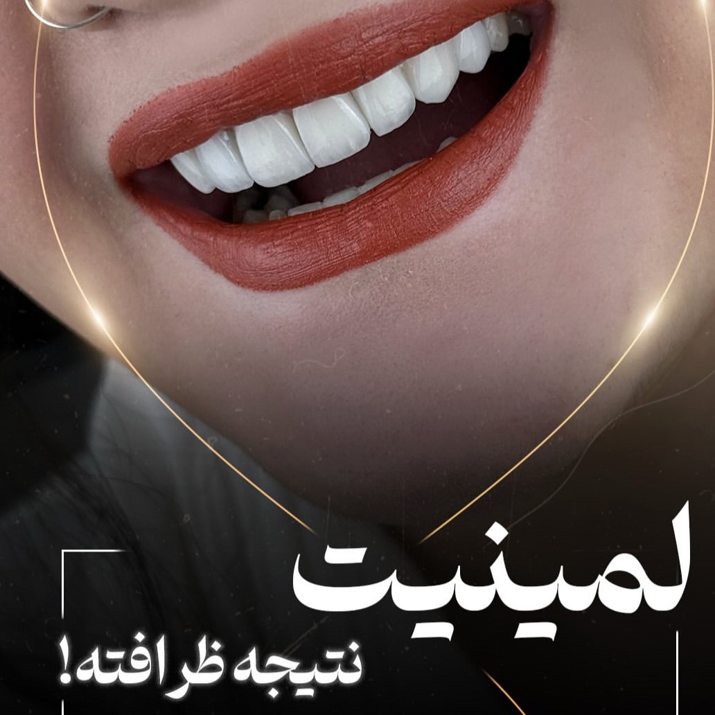 لمینیت نتیجه ظرافته